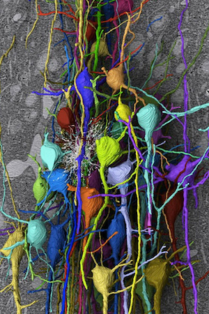 neuroanatomical imaging