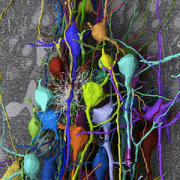 neuroanatomical imaging